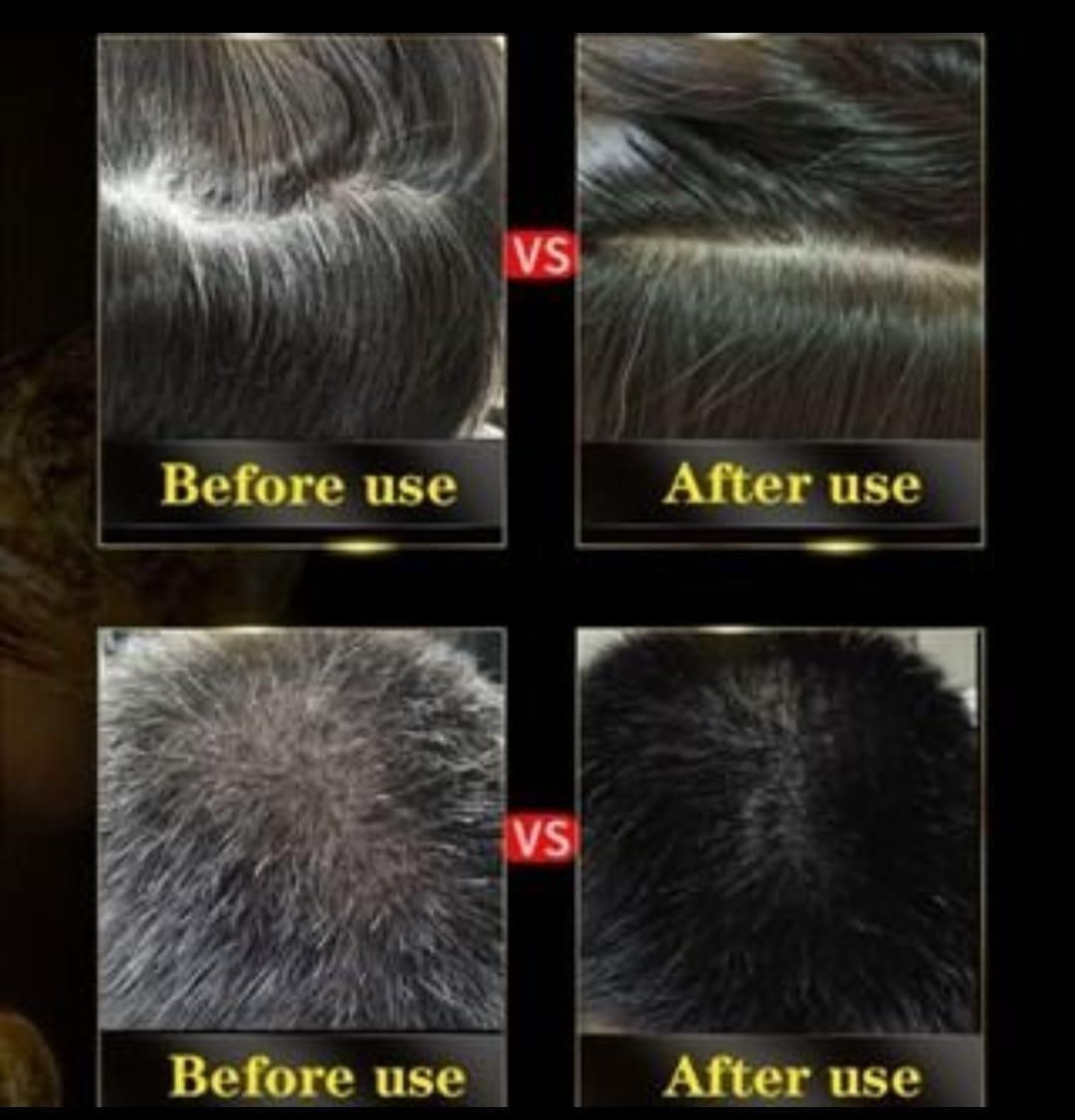 Unisex Instant Black Herbal Hair Dye Shampoo for Grey Hair Coverage Shampoo 3 in 1(100ml) Pack Of 2 - ViralBuy